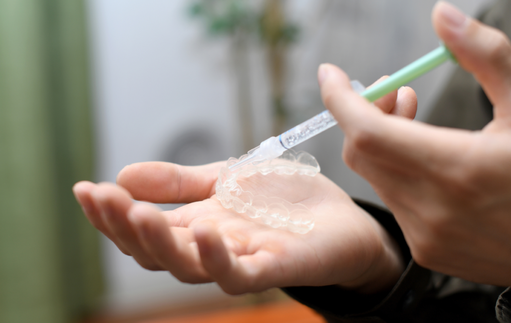 Blanchiment interne Dentiste Dr Attuil Régis | Endodontie à Paris 17